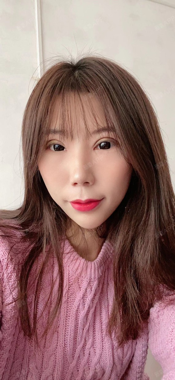 哈喽各位姐妹,我来更新日记了,不知不觉割完双眼皮就_圈子-新氧美容