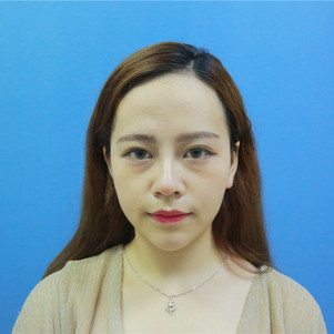 【m22王者之冠】【m22-aopt超光子嫩肤】全模式第七代美白嫩肤祛斑