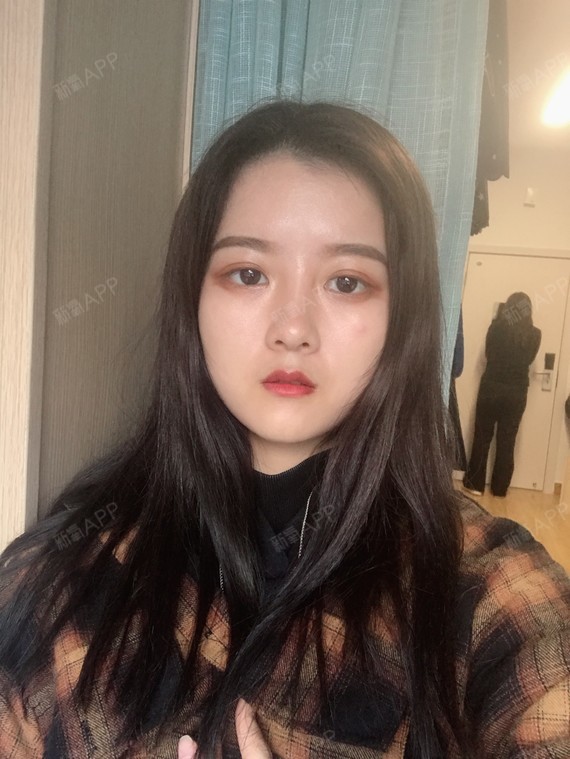 很多人都说我的嘴巴太小了,我之前都没有发现,后来看_圈子-新氧美容