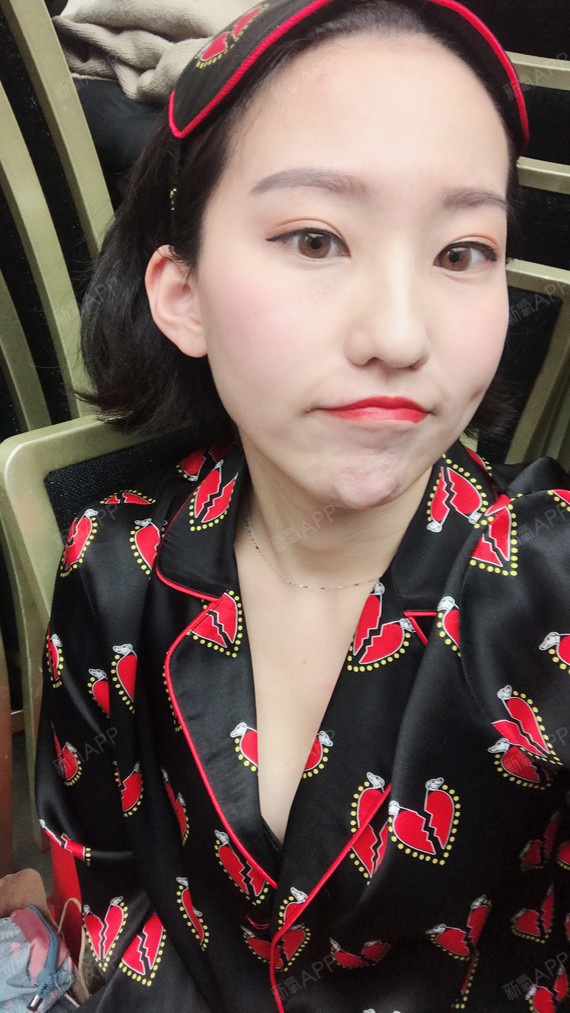 瘦脸针的效果一天比一天好哦,现在整个脸都小了一圈,_圈子-新氧美容