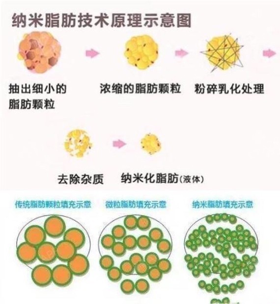 纳米脂肪是什么?