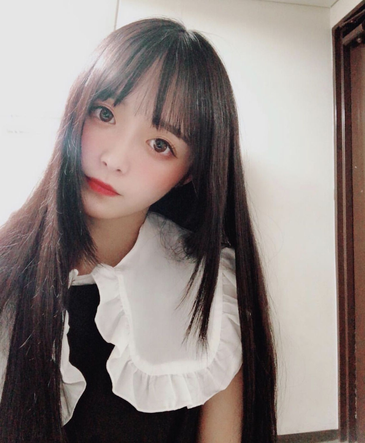 深圳千羽医疗美容医院微针美塑怎么样_恢复过程_效果