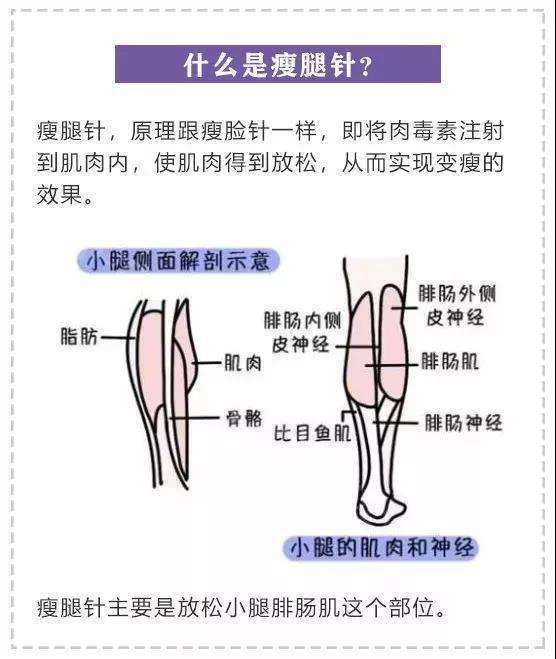 肉毒素瘦小腿需要多大的量