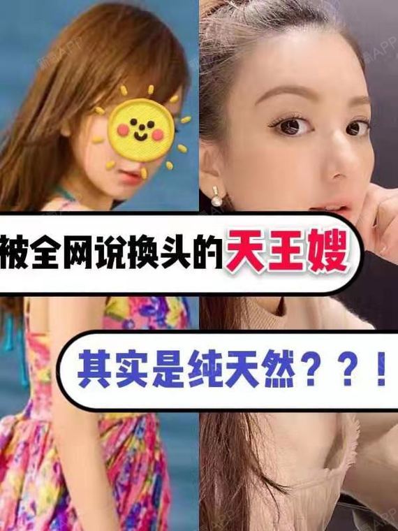 羊崽崽们好 结婚了吗 有男朋友了吗 没有的话 要不 圈子 新氧美容整形