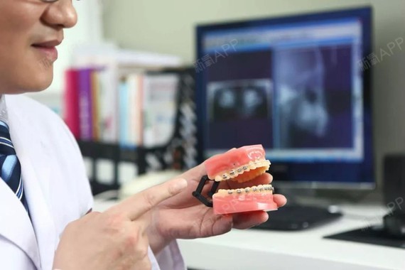 对牙齿矫正的疑惑,通通帮你解答!