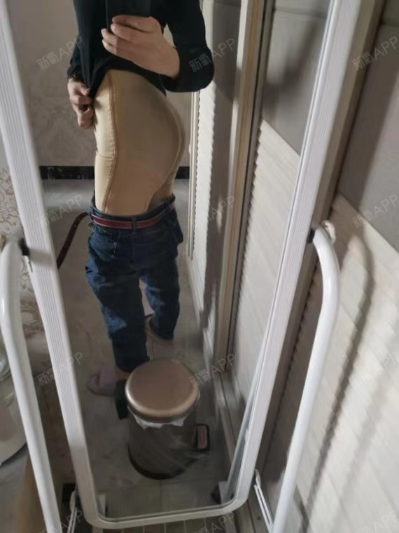 假体丰臀第8天现在的屁股比之前翘了好多,大小和形状_圈子-新氧美容