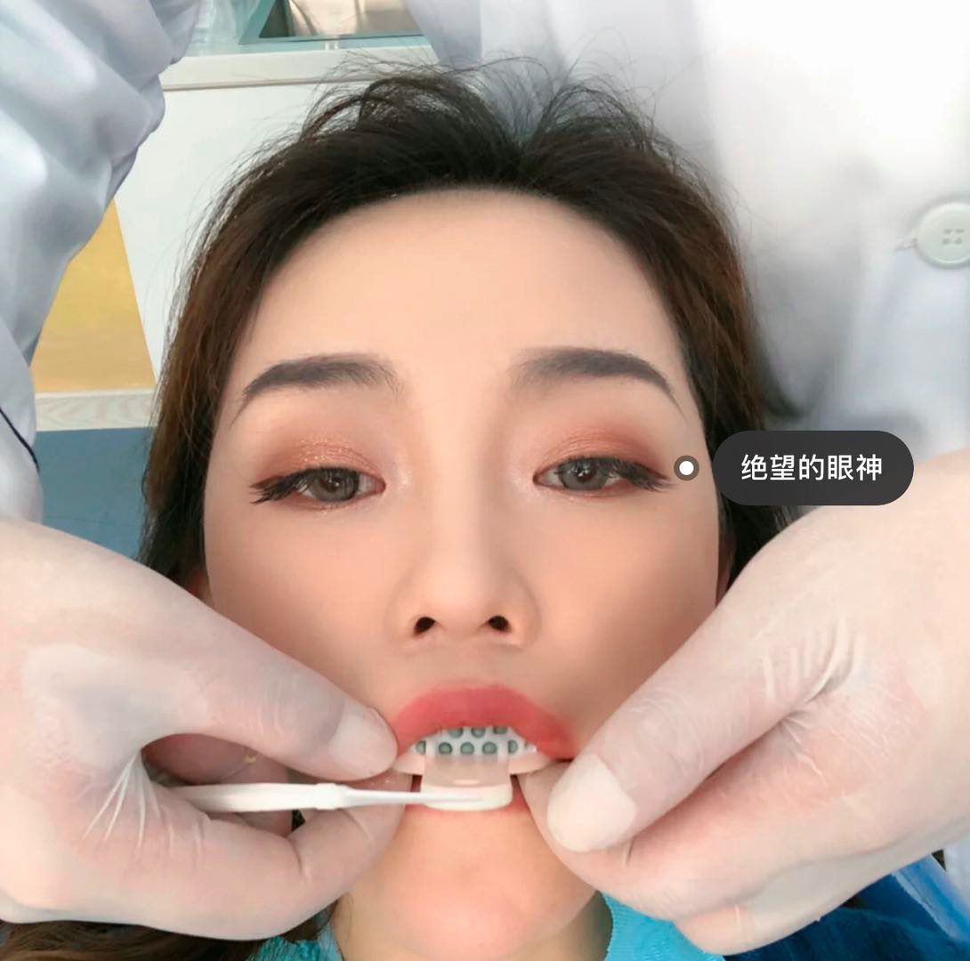 励志篇/12颗烤瓷牙的经历