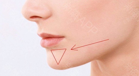 降下唇肌,位于下唇下方,颏肌的上方,哭泣的时候,降下唇肌收缩,并使