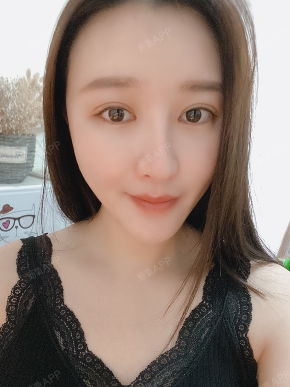 【青岛伊美尔5s重睑术 超微创开内眼角】时间过得好_圈子-新氧美容