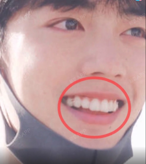 肖战要凉了?他粉丝管不好 牙管的挺好的