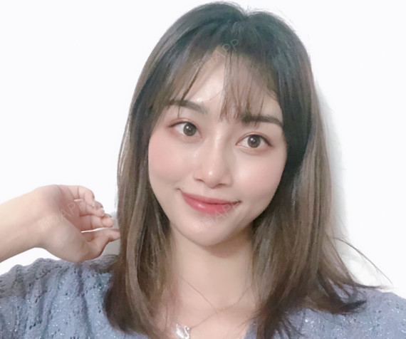 微调一下的鼻子,就是拥有了不经意间的美丽,在某一个_圈子-新氧美容