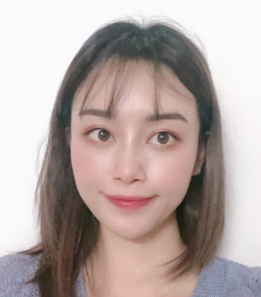 微调一下的鼻子,就是拥有了不经意间的美丽,在某一个_圈子-新氧美容