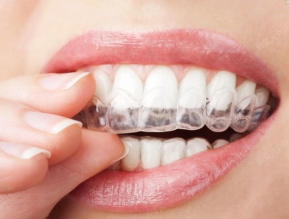 很多人想矫正牙齿,但是担心带上牙套不好看,又担心生_圈子-新氧美容