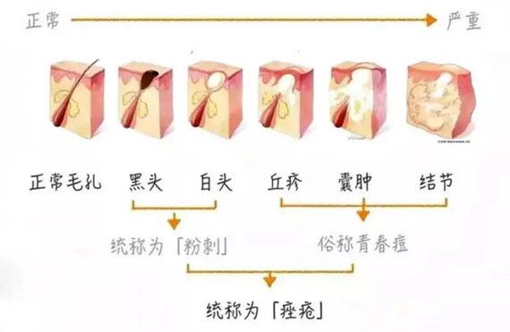 如何解决脸上的黑点点