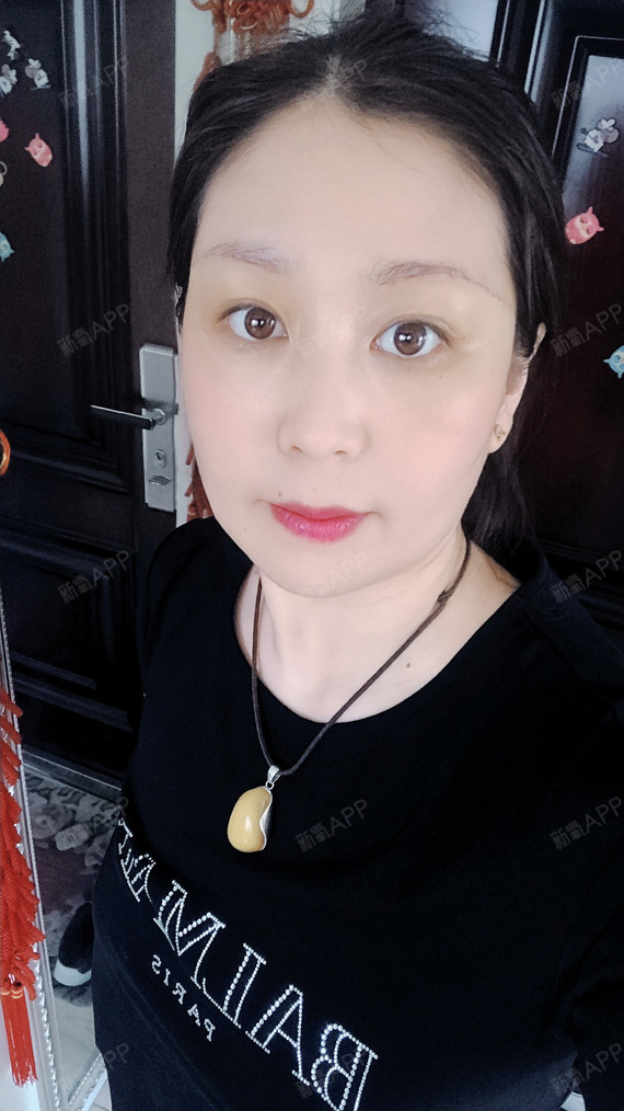 提眉术多久可以恢复自然_眉毛术后修复_眉毛提升手术