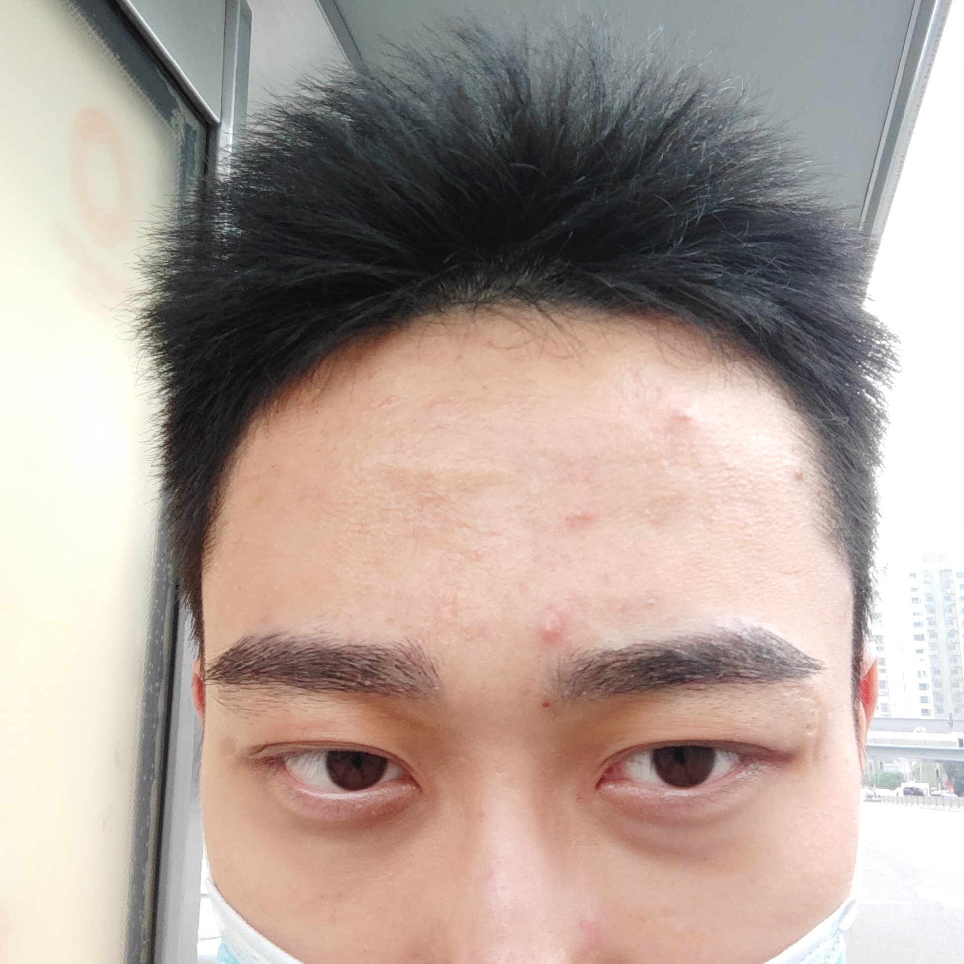 植眉之后5天了,很满意自己的眉毛,就是想要这种很浓_圈子-新氧美容