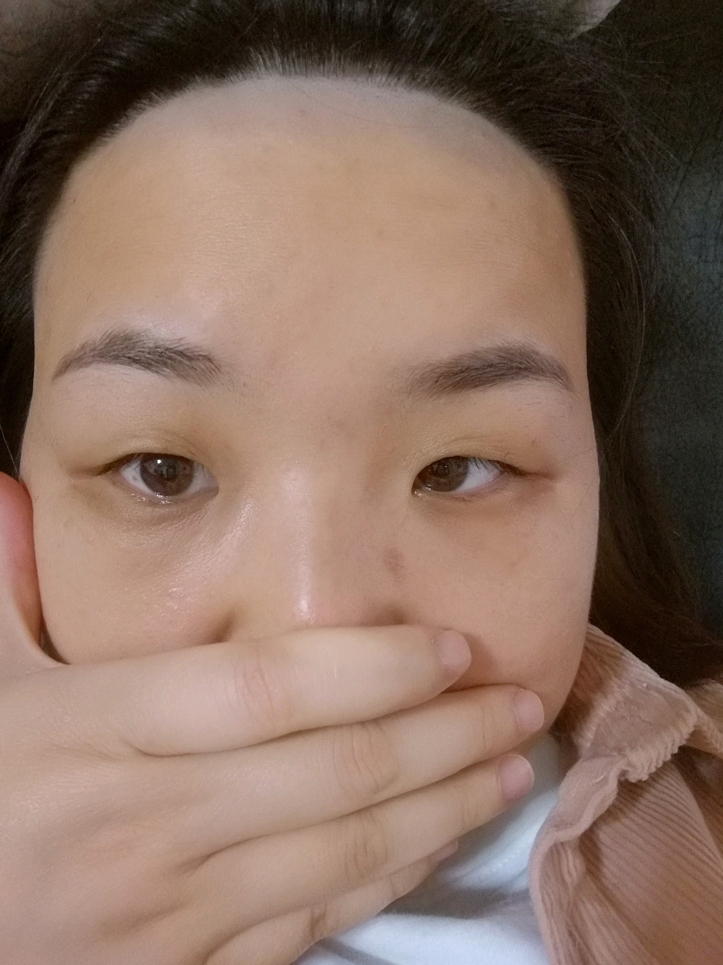 【激光脱毛】脱络腮胡 6次 ,【维多利亚】冰点脱毛 脱发际线/络腮胡 6