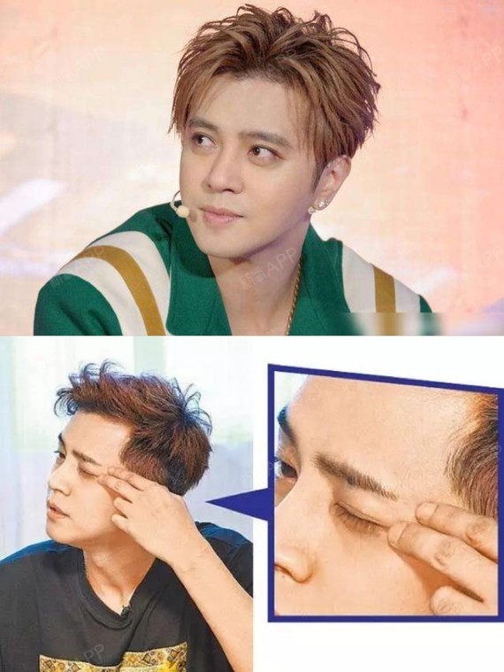 罗志祥这些年就只do了双眼皮?