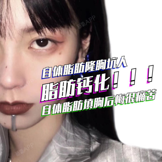 自体脂肪隆胸坑人,自体脂肪填胸后悔很痛苦,脂肪钙化!