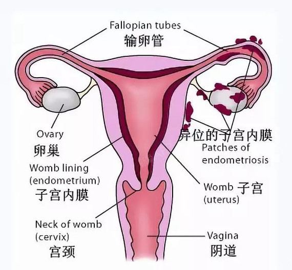 卵巢在腹部的位置图片图片