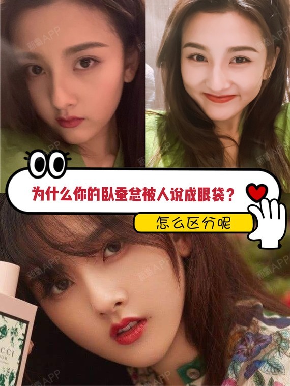 首页 此页面仅支持预览 Avatar 安妮思密达 167篇日记 为什么你的卧蚕总被人说成是眼袋 卧蚕和眼袋最大的差别在哪里 上一期安妮分享了眼袋 有很多直男还有很多宝宝分不清眼袋和卧蚕 眼袋开始很显老的 卧蚕可是加分项 分清哪个是卧蚕还是很有