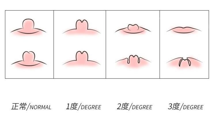 怀孕乳头变化图图片