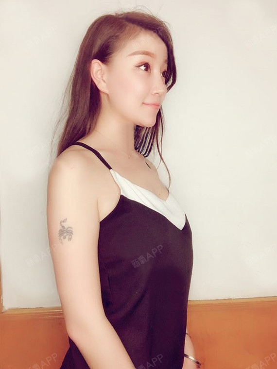 【假体隆胸第1天】