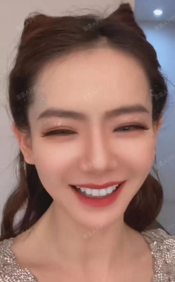 塞牙牙缝宽大能贴面吗?