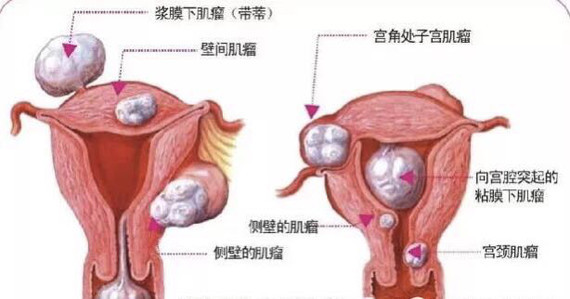健康知识:28岁卵巢早衰,吃什么可以保护卵巢!