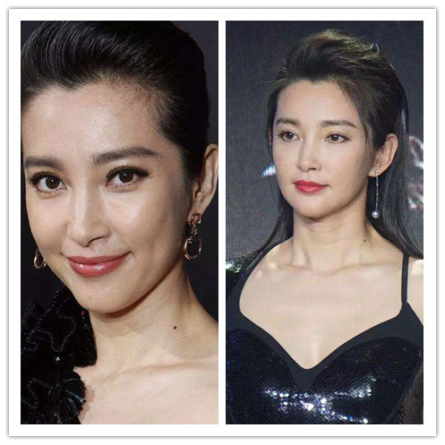 06之前给大家讲解了颈纹的形成原因和一些保养手段,很_圈子-新氧