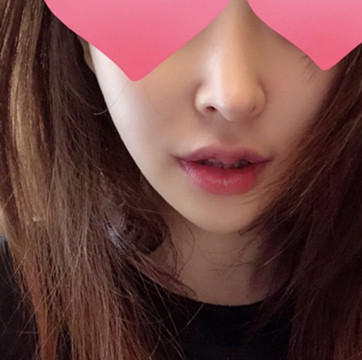 从一开始的嘟嘟唇,又到m唇,pp唇,花瓣唇.看着别_圈子-新氧美容整形