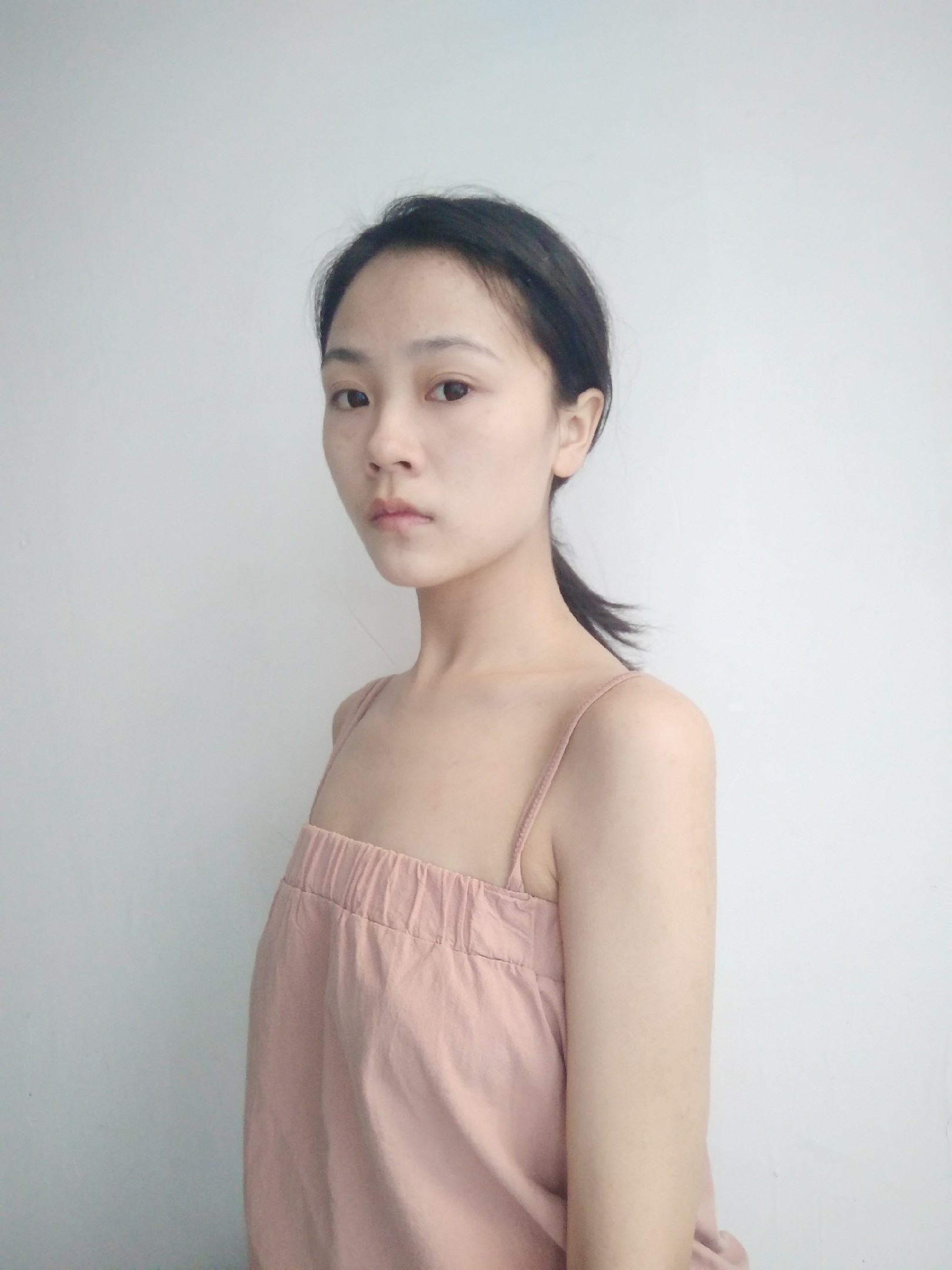 【假体隆胸术后第0天】#关于假体隆胸 #丰胸 96终_圈子-新氧美容