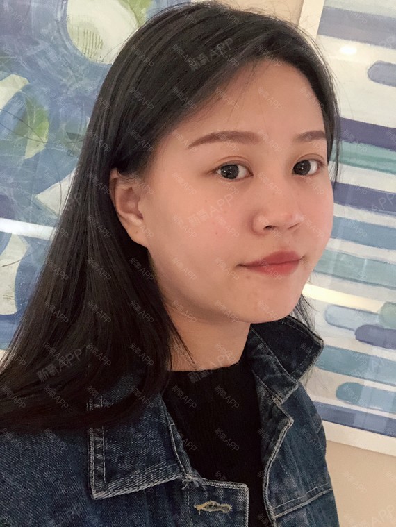 耳软骨隆鼻第0天#我的脸型属于圆脸型,但鼻子长度_圈子-新氧美容招挝