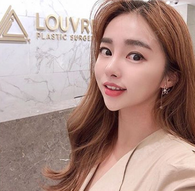 韩国比较出名的小众 眼鼻 整形医院 价格低案例惊艳 圈子 新氧美容整形