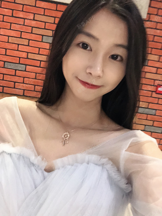 术后269天今天是闺蜜大喜的日子,我来做伴娘了,希_圈子-新氧美容整形