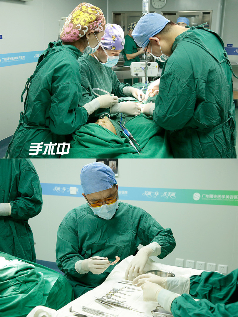 请问我适合做鼻翼缩小手术吗