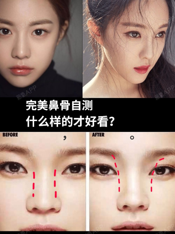 很多人更_圈子-新氧美容整形