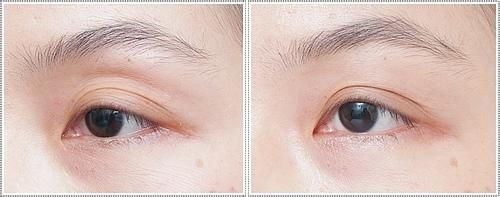 像女明星一样的眼凹,你知道是怎么回事吗