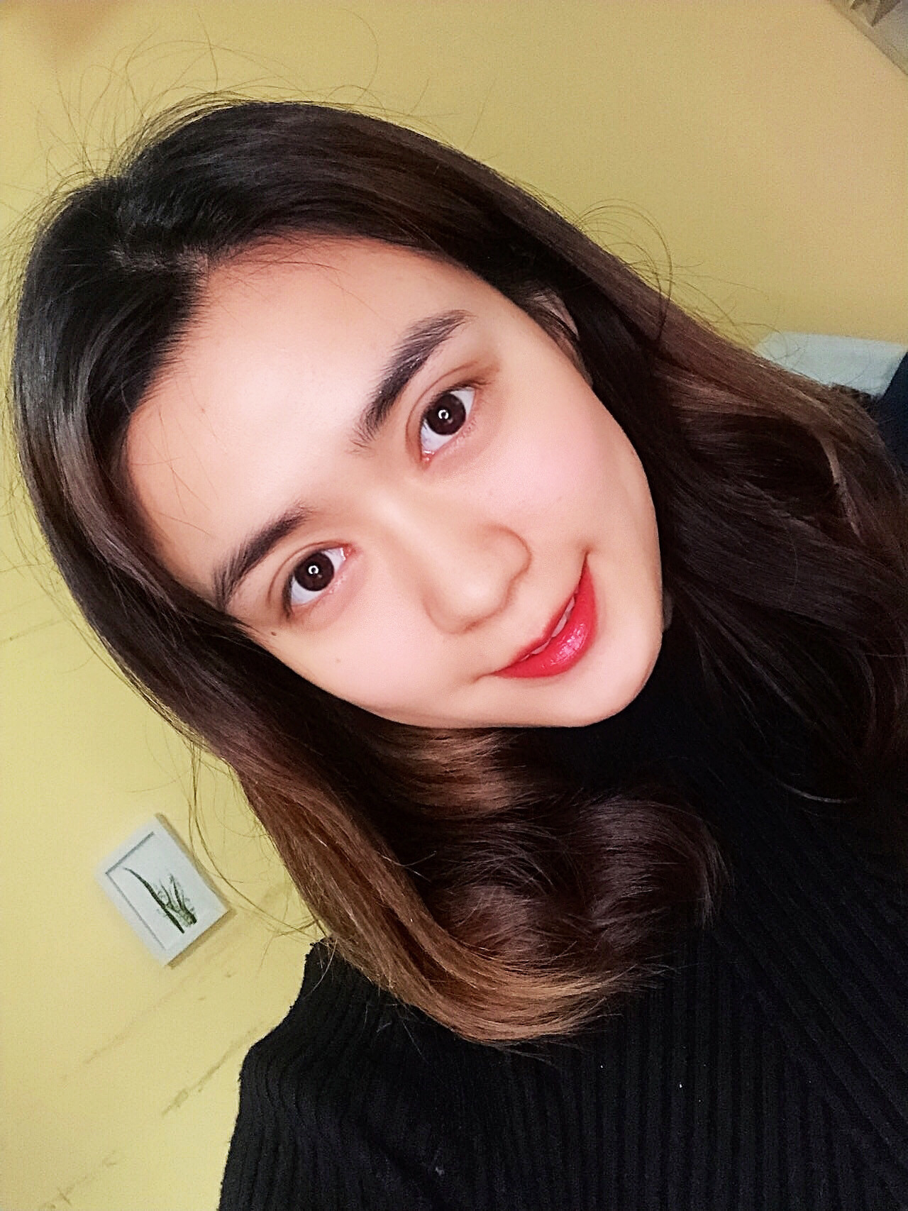 【广州曙光官方案例】瘦脸效果这么明显到底怎么做到的?