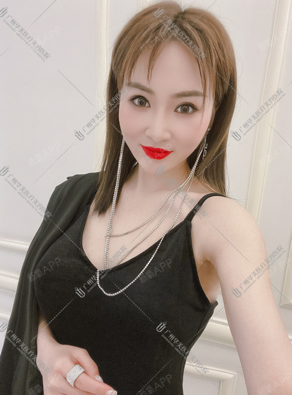 胸小尴尬?不是所有的"a"代表优秀!相信很多人_圈子-新氧美容整形