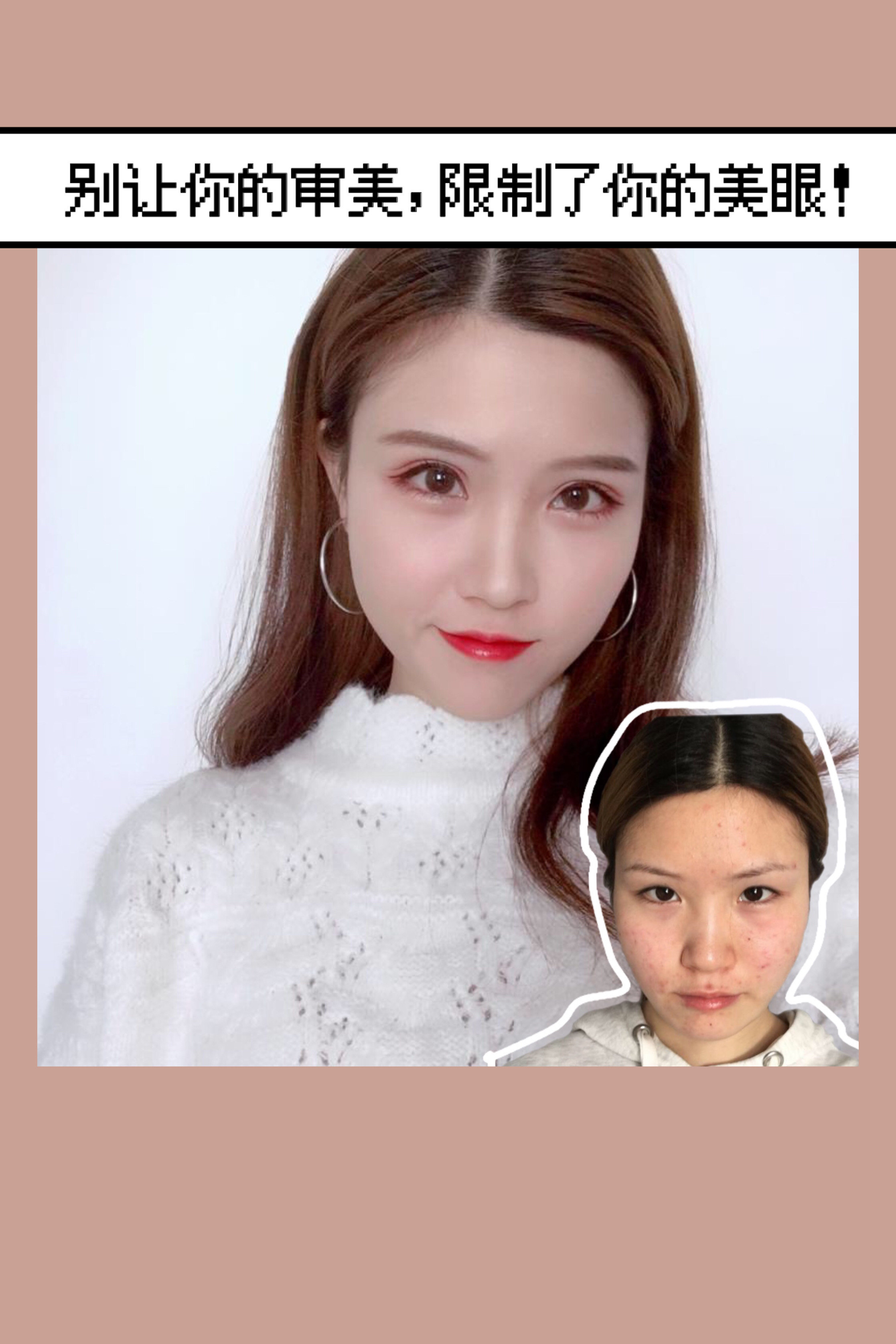 很多爱美_圈子-新氧美容整形