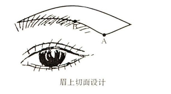 哭,切眉增生会消失吗?我后悔做切眉手_圈子-新氧美容整形