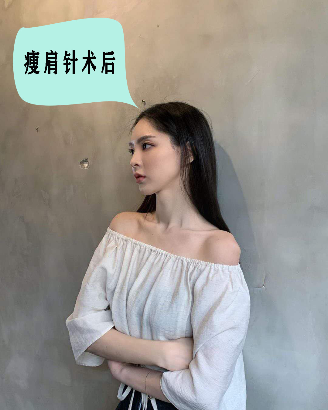 连续注射瘦肩针会有副作用吗