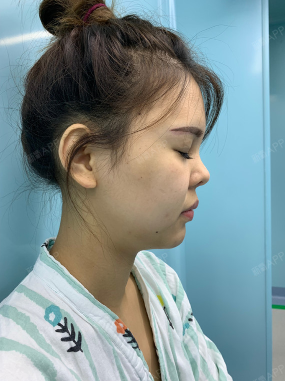 我做的是欧式风的~弧度我很喜欢,像天生的一样,_圈子-新氧美容整形