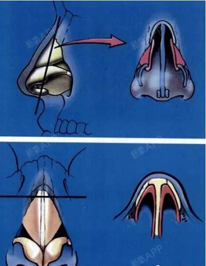 圖解鼻子構造