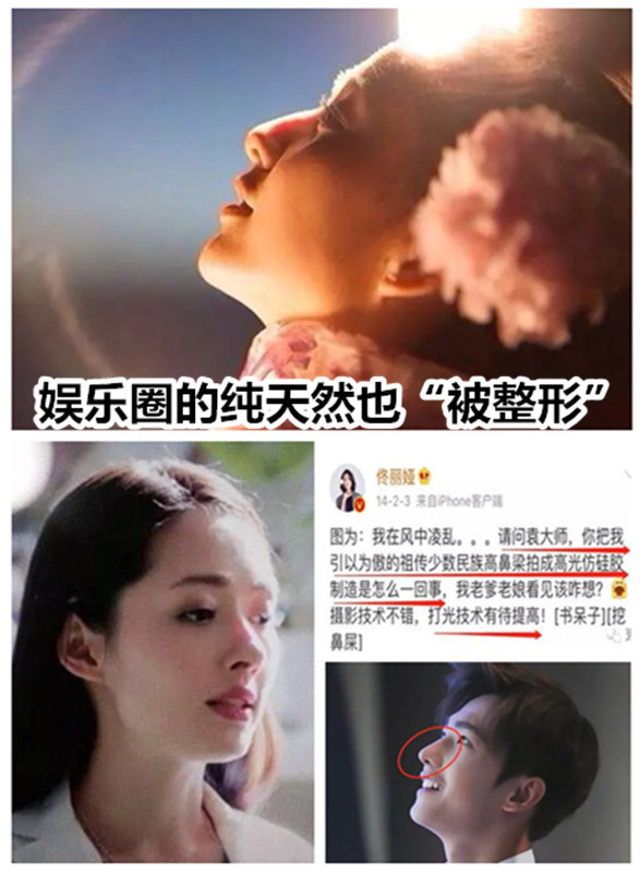 鼻子透光一定是假的71no7515事实上天生的鼻子也会透_圈子-新氧