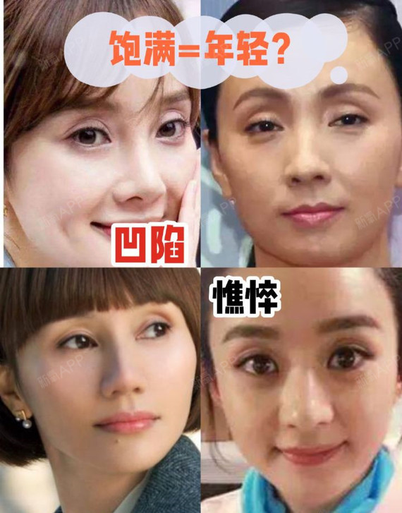 眼窝凹陷