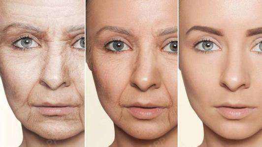 皱纹是岁月在脸上划过的痕迹,随着年纪越来越大,各种皱纹也越深,尤其