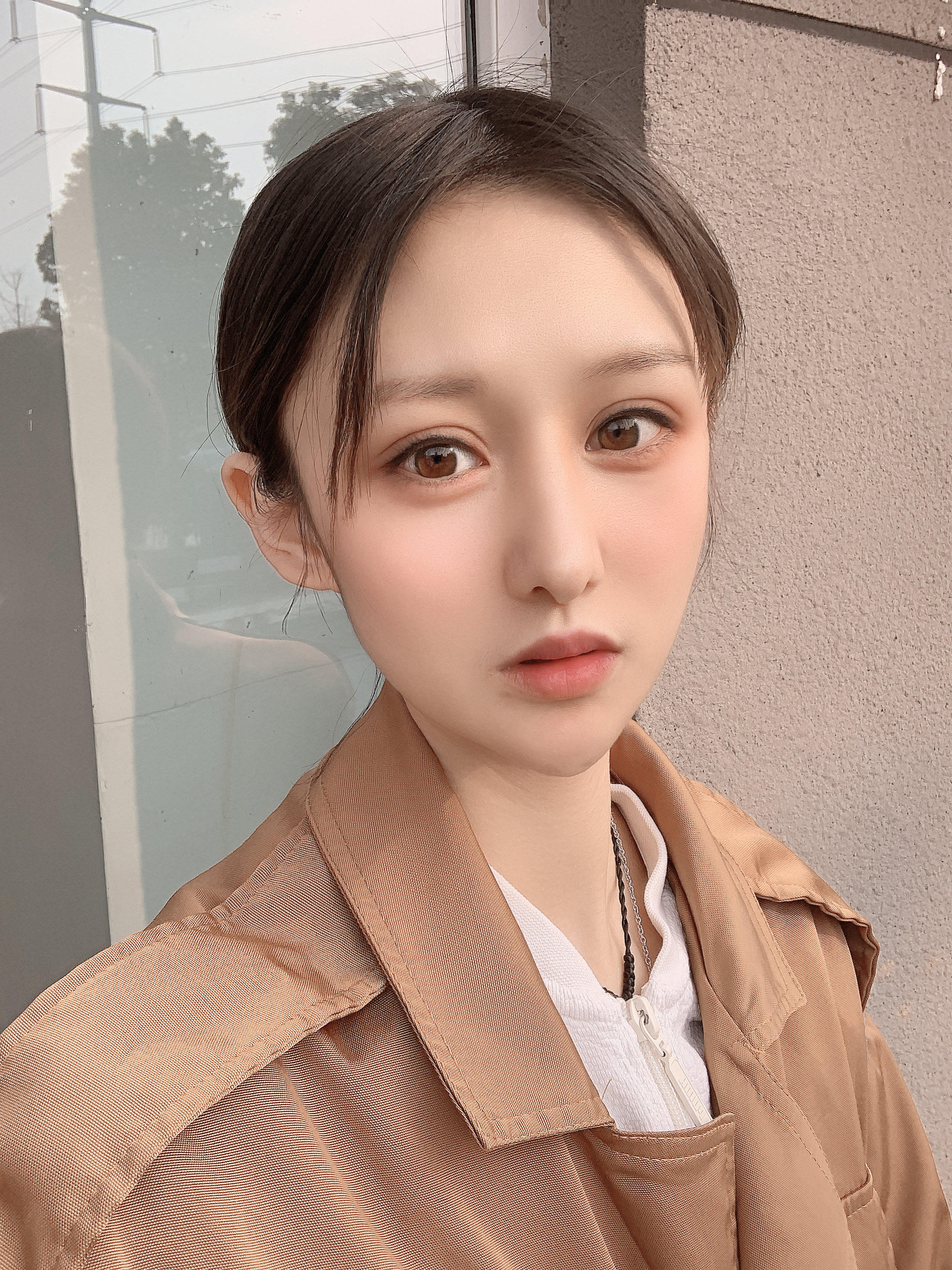 【南京美贝尔—眼修复】*[:60]现在做双眼皮的人_圈子-新氧美容整形