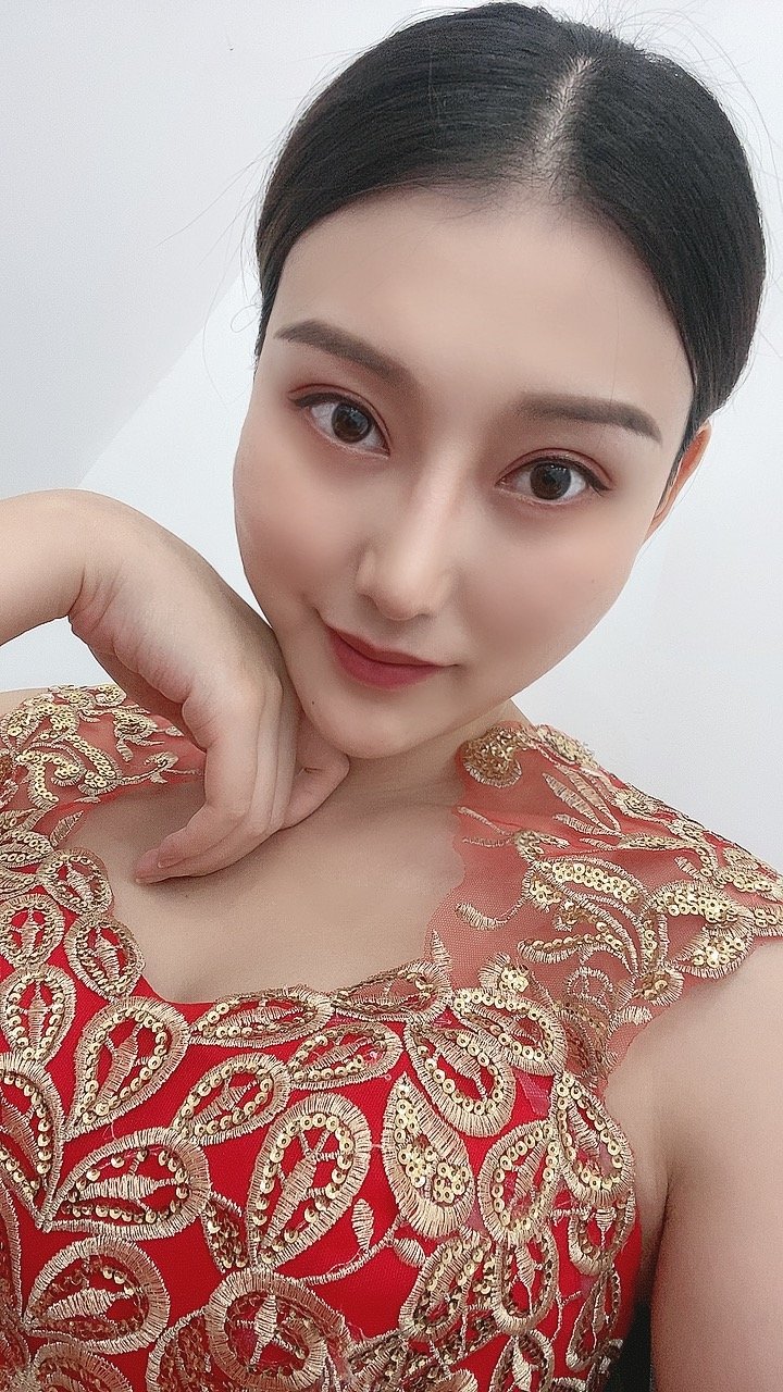 【淄博美联臣—切开双眼皮第257天】自从调整了眼睛_圈子-新氧美容